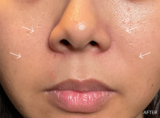 Porcelain Skin