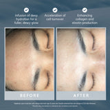CO2 Skin Renewal CO2 Skin Renewal