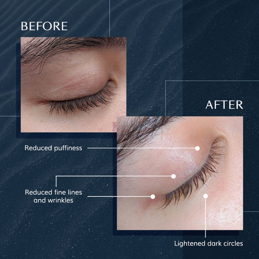 Multi-Spectrum Intensive Eye Treatment