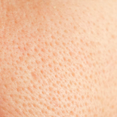 Porcelain Skin