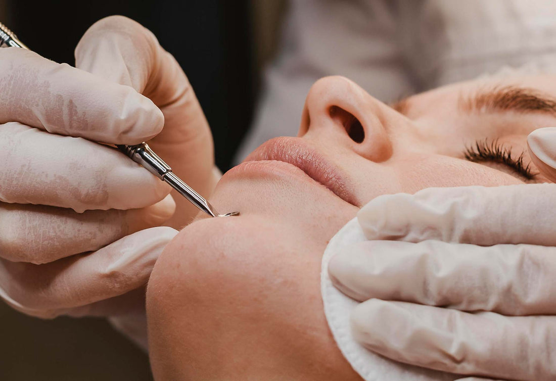 All Every Singaporean Needs to Know About Blackhead Extraction